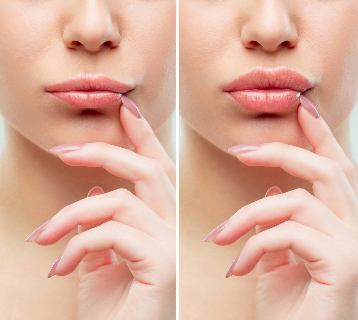 Come avere labbra carnose Come avere labbra carnose