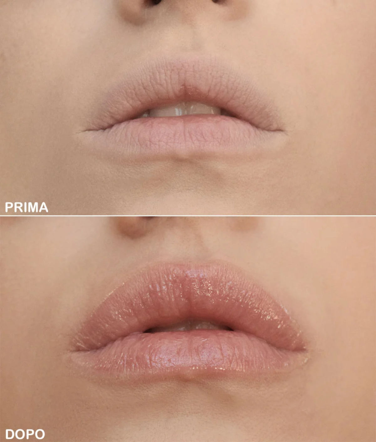 Come avere labbra carnose senza trucco Come avere labbra carnose senza trucco