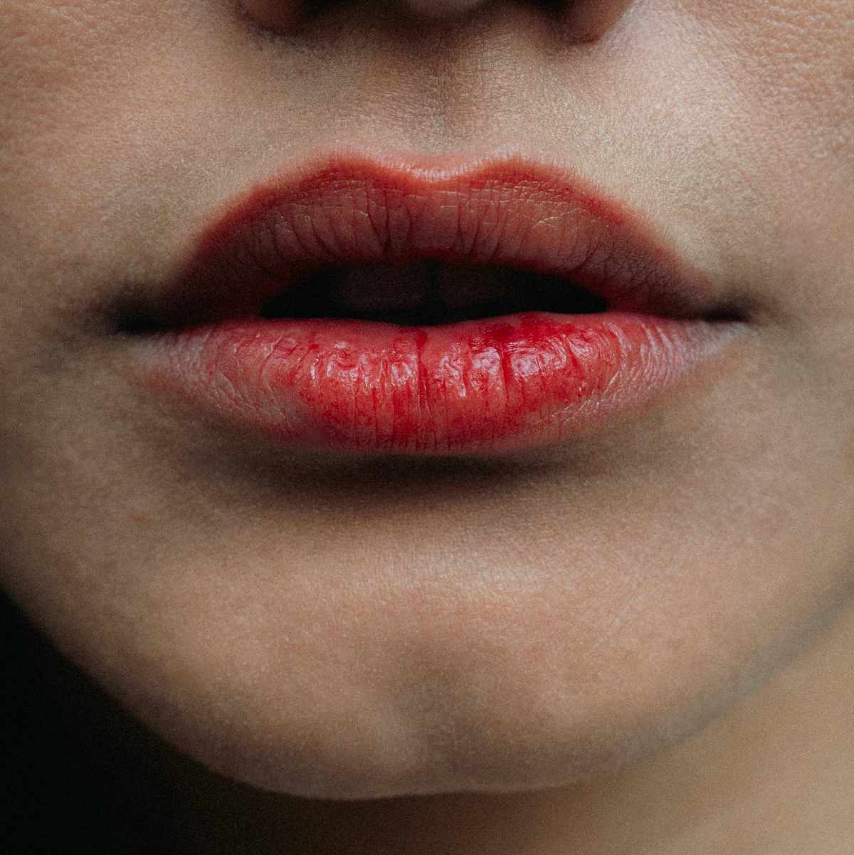 Cause labbra screpolate e secche Cause labbra screpolate e secche