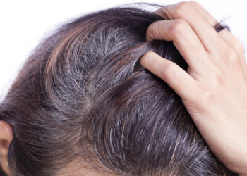 Perché i capelli diventano bianchi o grigi?