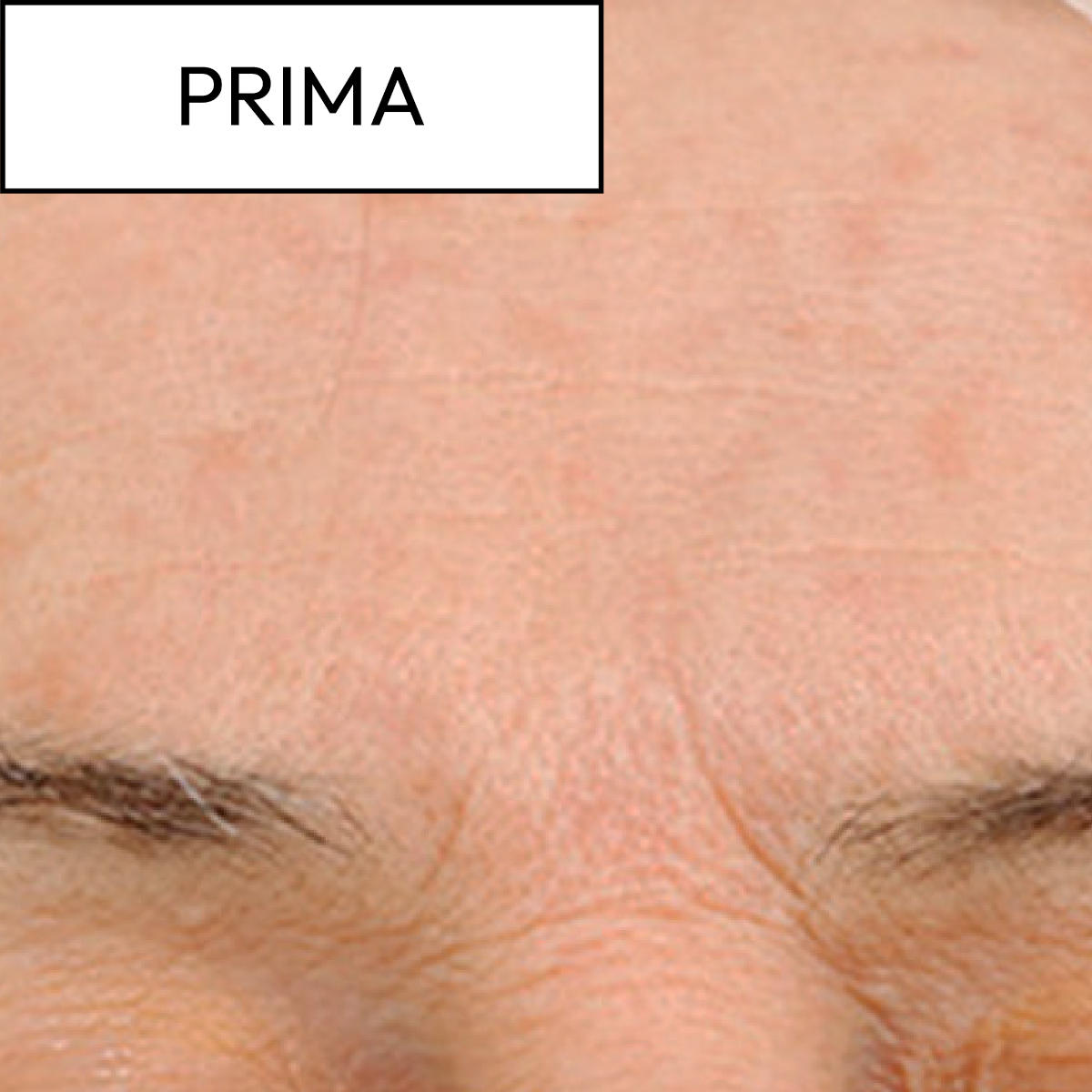 Trattamenti skincare per la pelle con macchie Trattamenti skincare per la pelle con macchie