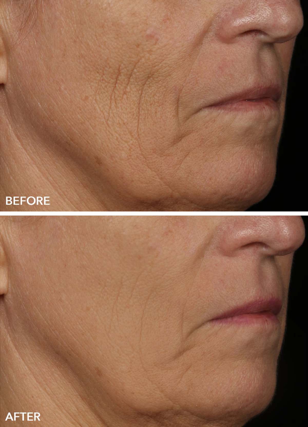 Maschera LED per la cura della pelle Maschera LED per la cura della pelle