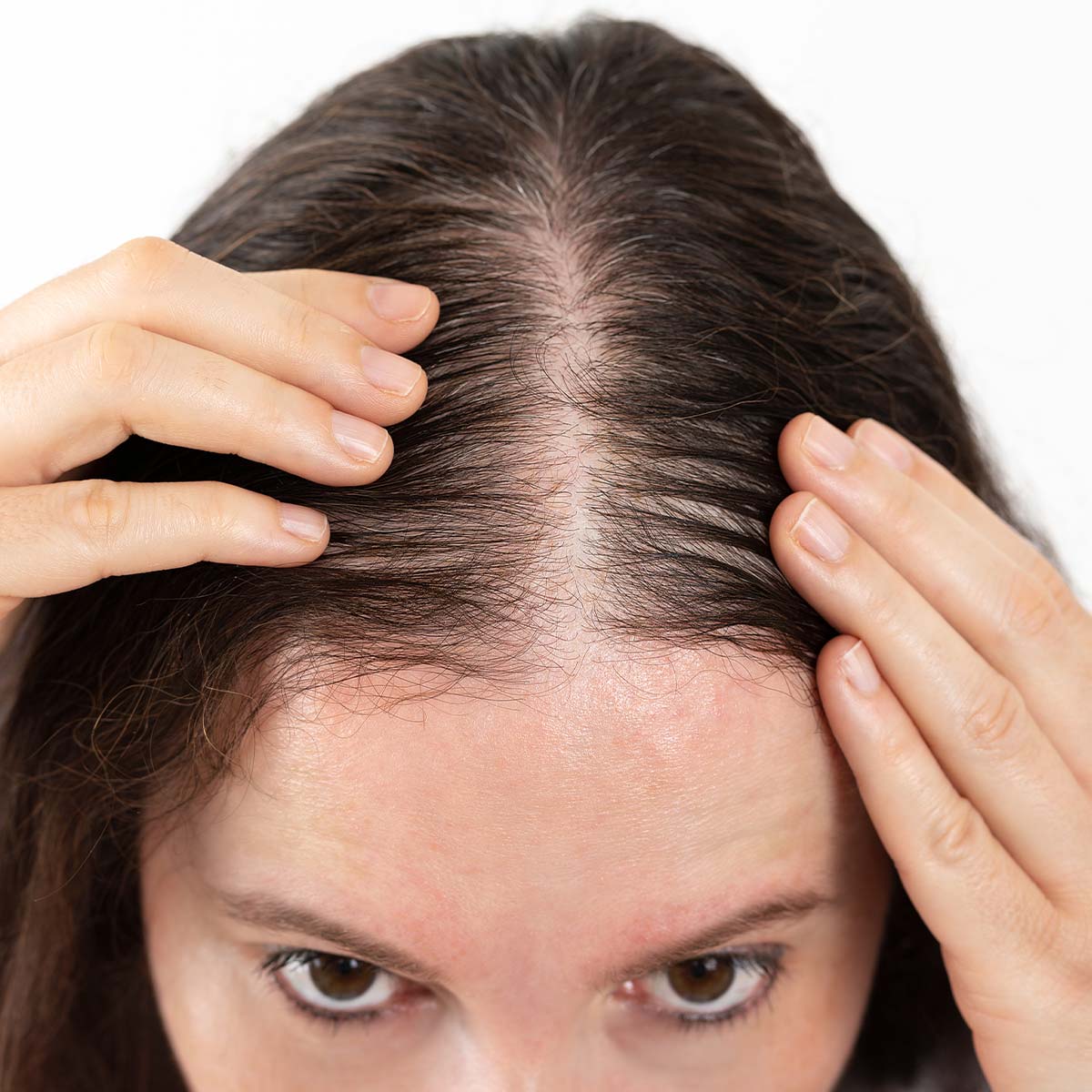 Capelli fini e pochi Capelli fini e pochi